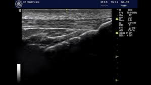 MSK Ultrasound