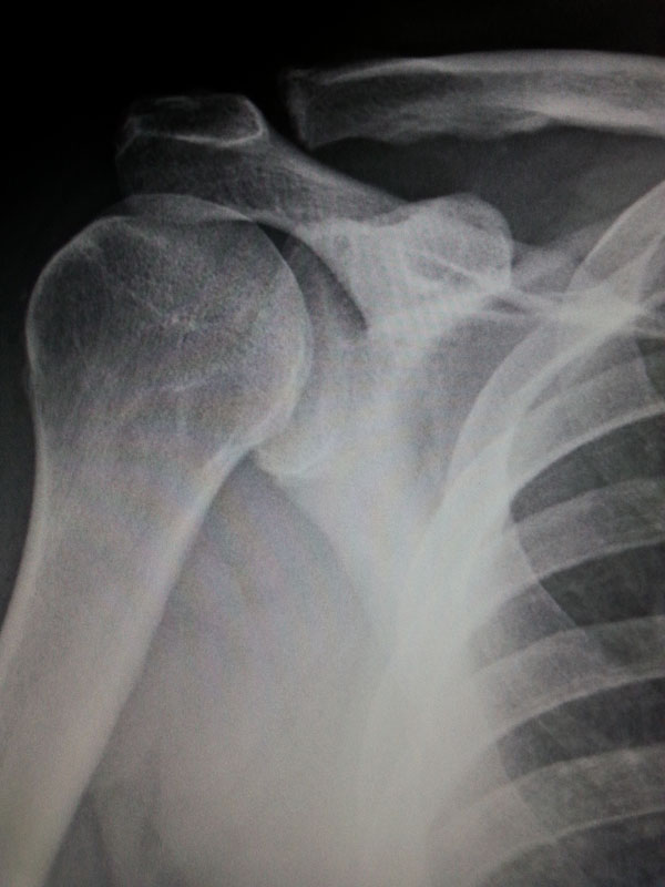 Digital Radiology