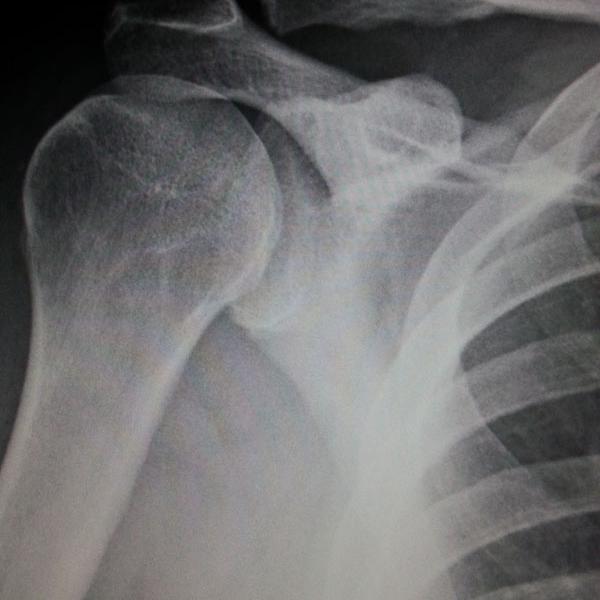 Digital Radiology