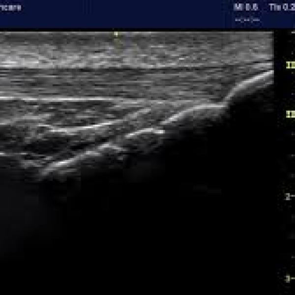 MSK Ultrasound